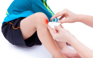Injury To Childs Knee on Paediatric First Aid Course