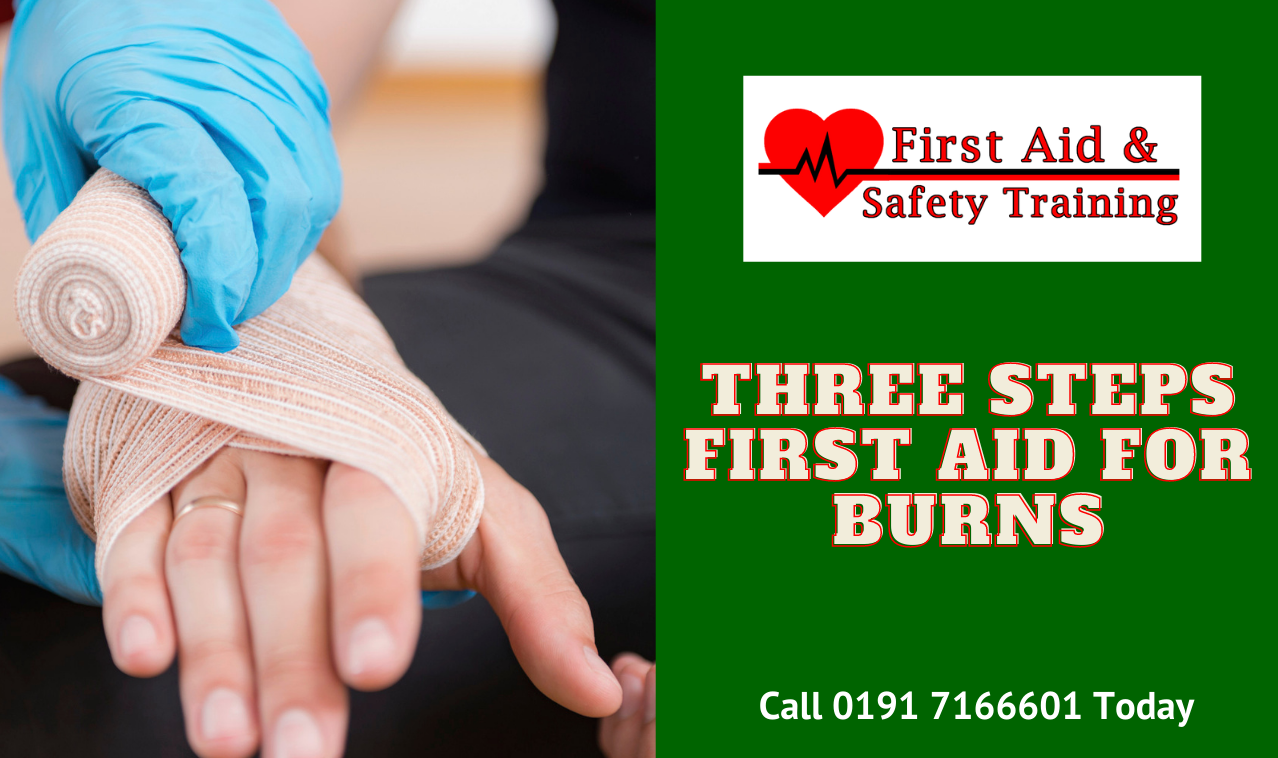 Three Steps First Aid For Burns Burns First Aid 3531