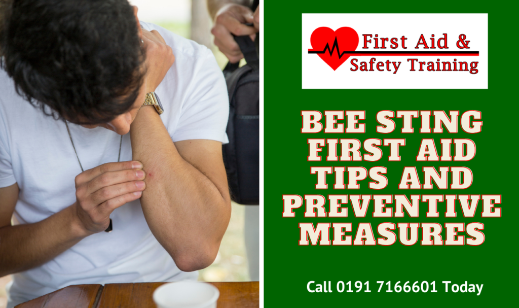 Bee Sting First Aid Tips and Preventive Measures