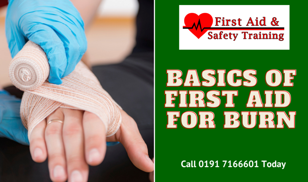 Basics of First Aid for Burn