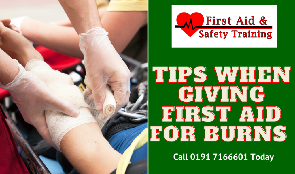 Tips when giving First Aid for Burns