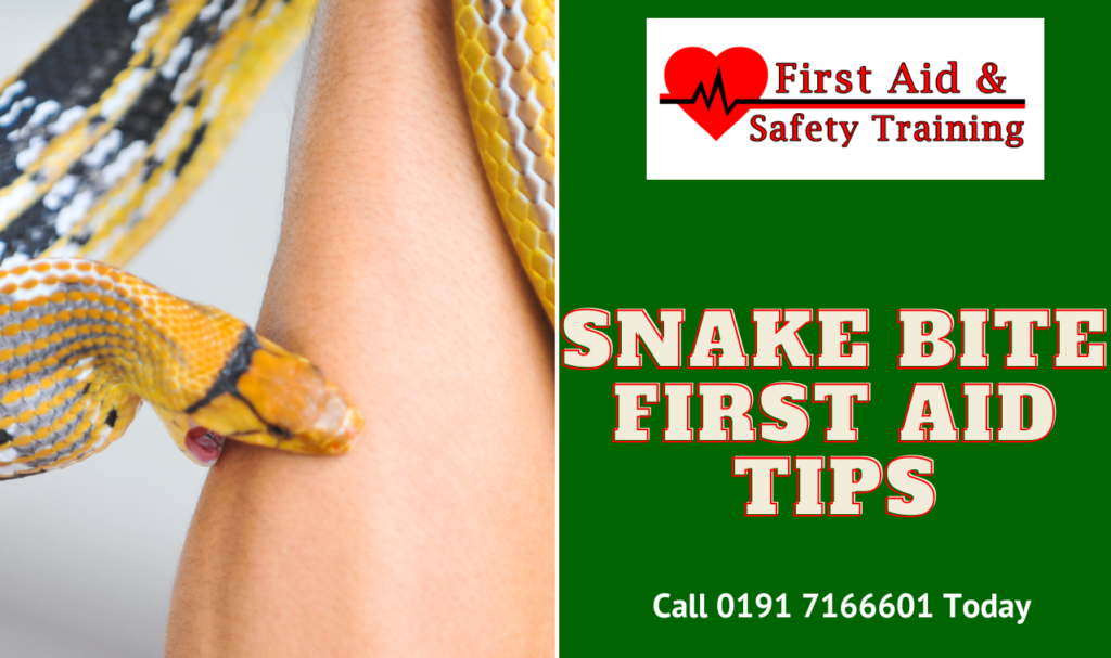 Snake Bite First Aid Tips