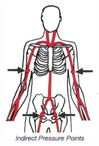 Treatment of external bleeding 2