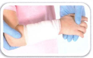 Treatment of external bleeding 3