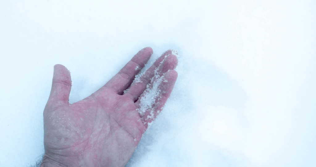 Dealing With Frostbite and Cold Injuries | First Aid Course