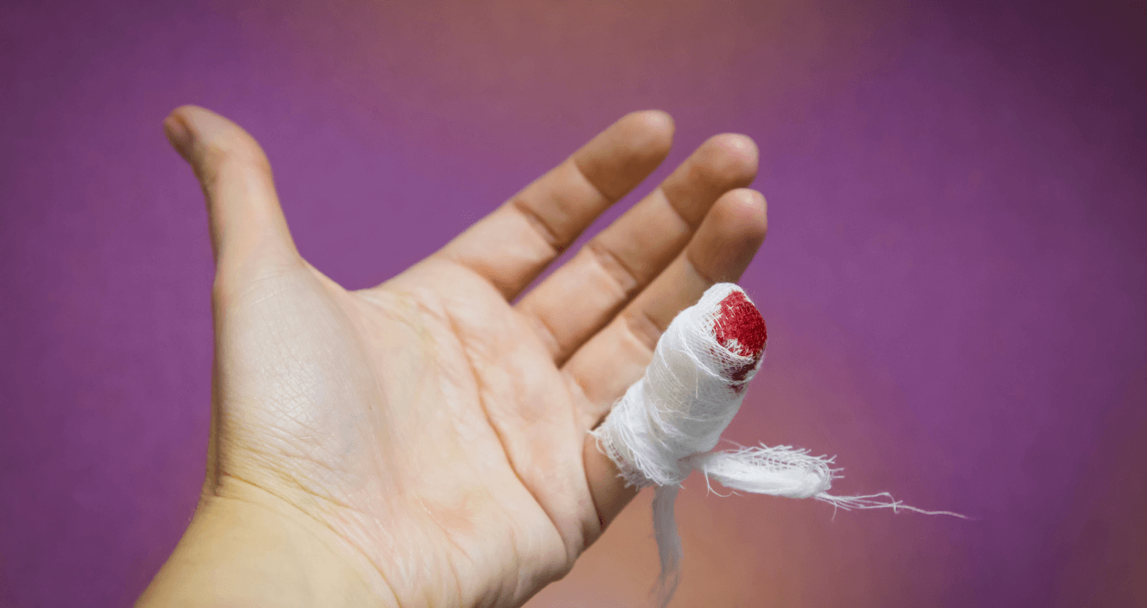 How To Deal With An Amputation | First Aid and Safety Training How To Deal With An Amputation